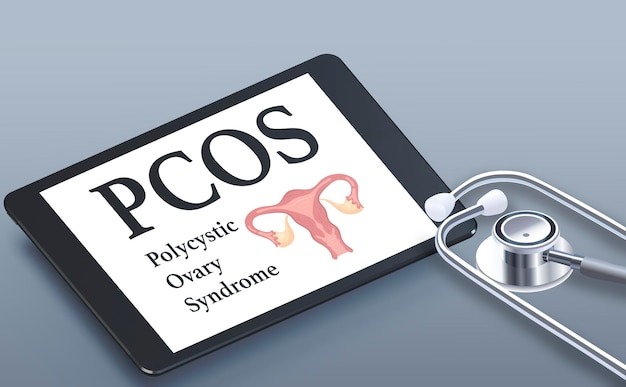 pcos treatment in indore